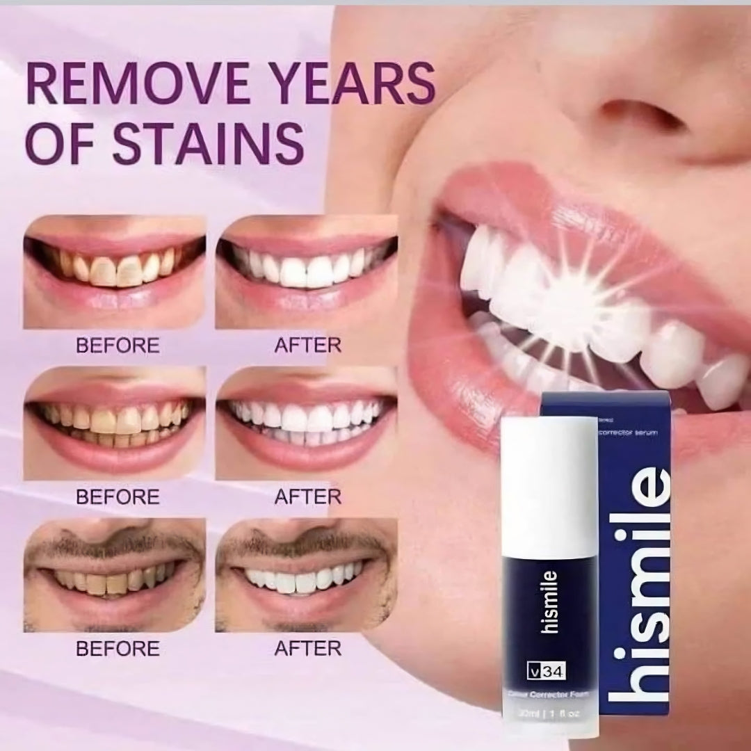 Hismile v34 Color Corrector