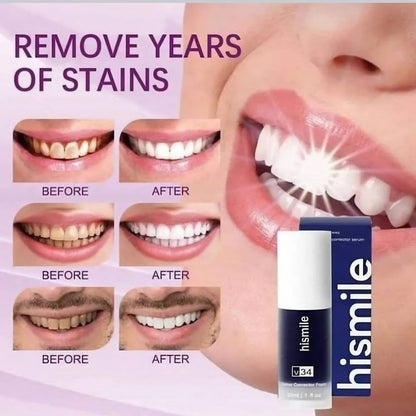 Hismile v34 Color Corrector