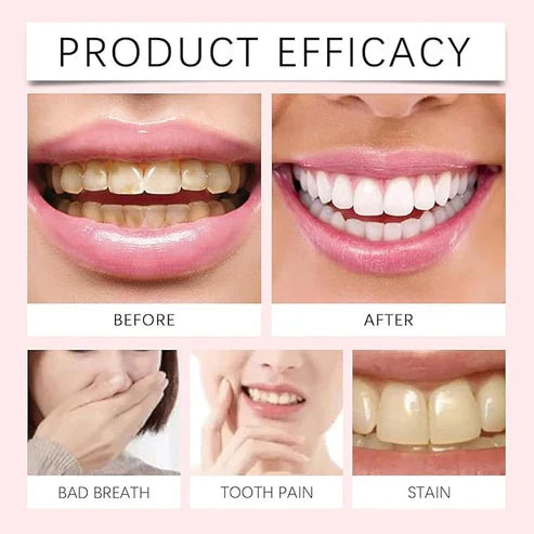 Oralhoe - Nicotinamide Dazzle White Toothpaste (Original)