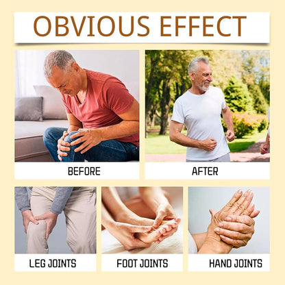 Bee Venom and Turmeric Joint Treatment Cream