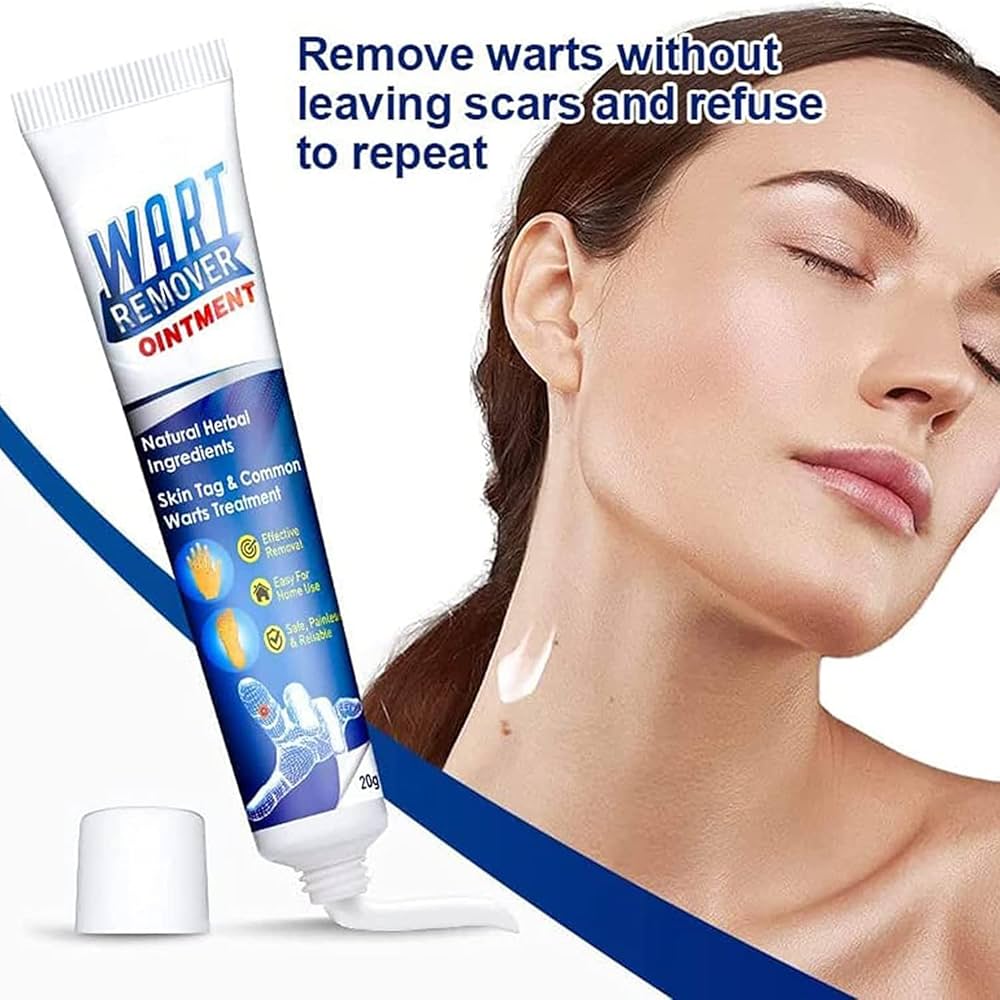 Wart Remover cream