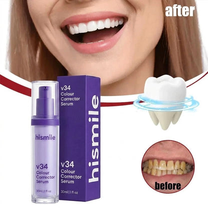 Hismile v34 Color Corrector