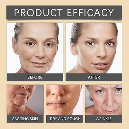 OUHOE - Bee Venom Botox Wrinkle Cream (Original)