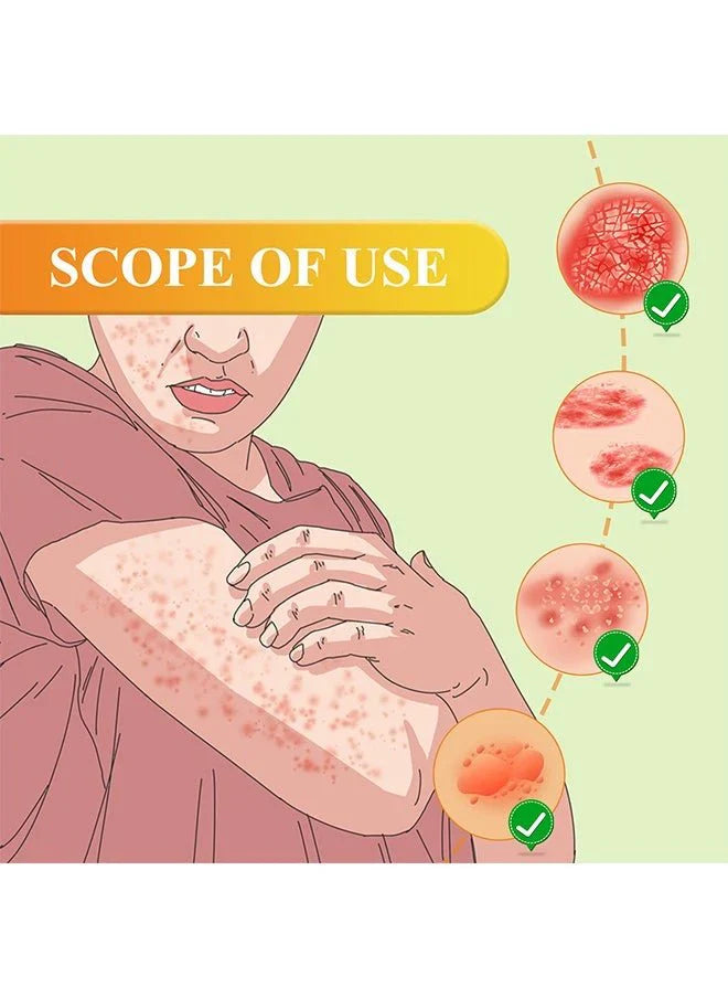 South Moon - Bee Venom Psoriasis Care Cream (Original)